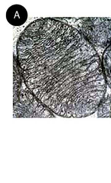 Micrografía de una mitocondria. Se observan las crestas mitocondriales